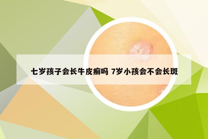 七岁孩子会长牛皮癣吗 7岁小孩会不会长斑