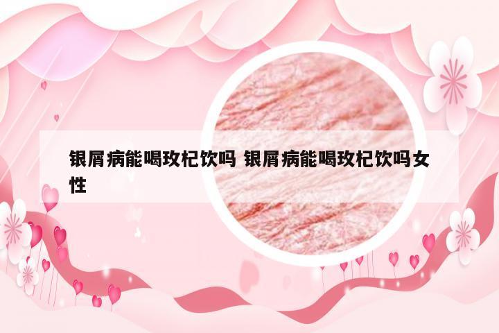 银屑病能喝玫杞饮吗 银屑病能喝玫杞饮吗女性