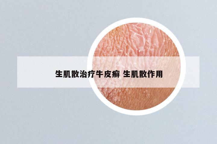 生肌散治疗牛皮癣 生肌散作用