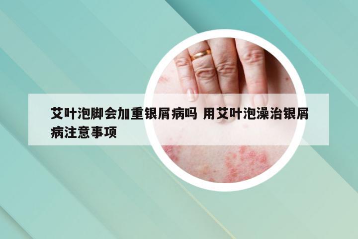 艾叶泡脚会加重银屑病吗 用艾叶泡澡治银屑病注意事项