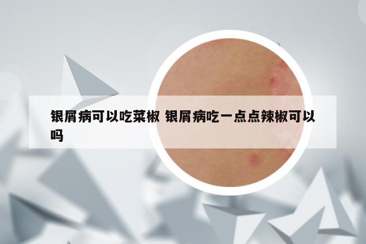 银屑病可以吃菜椒 银屑病吃一点点辣椒可以吗