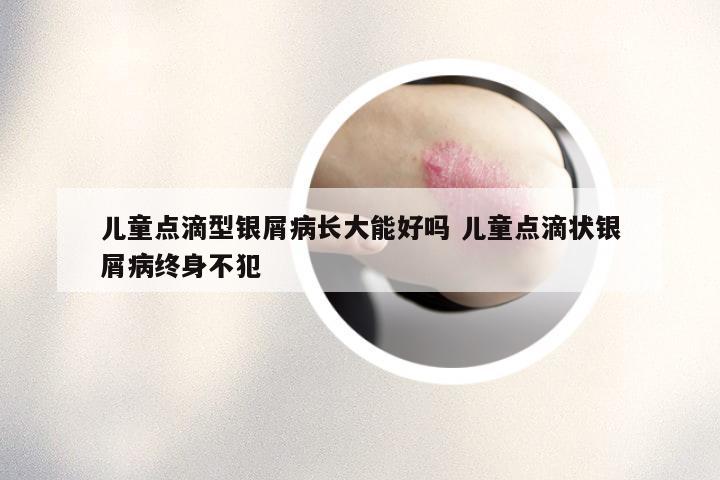 儿童点滴型银屑病长大能好吗 儿童点滴状银屑病终身不犯