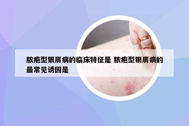 脓疱型银屑病的临床特征是 脓疱型银屑病的最常见诱因是