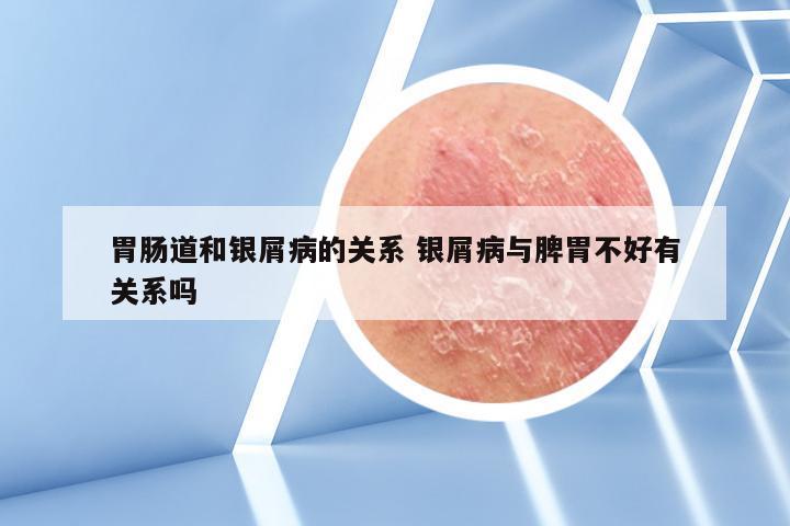 胃肠道和银屑病的关系 银屑病与脾胃不好有关系吗