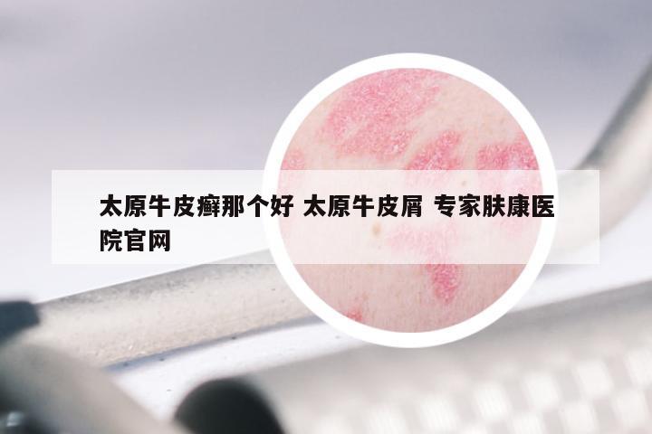 太原牛皮癣那个好 太原牛皮屑 专家肤康医院官网