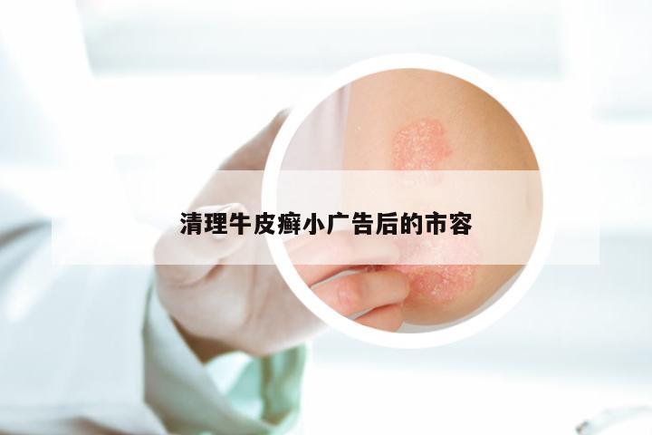 清理牛皮癣小广告后的市容