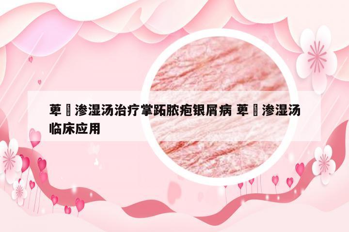 萆薢渗湿汤治疗掌跖脓疱银屑病 萆薢渗湿汤临床应用