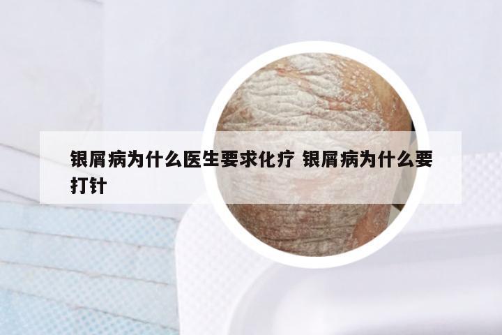 银屑病为什么医生要求化疗 银屑病为什么要打针