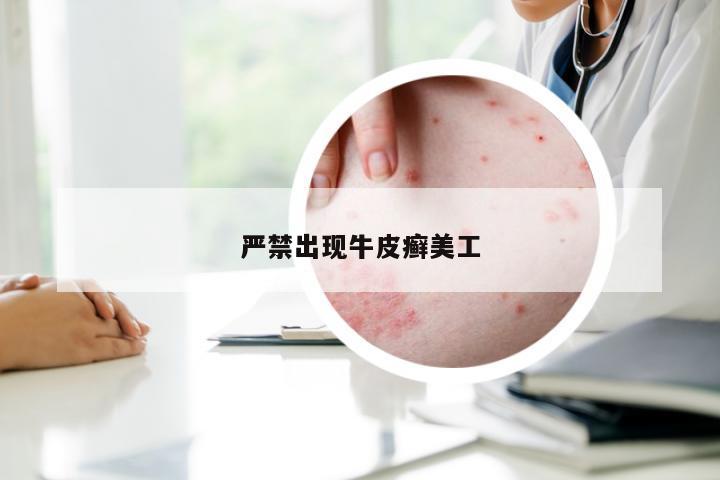 严禁出现牛皮癣美工