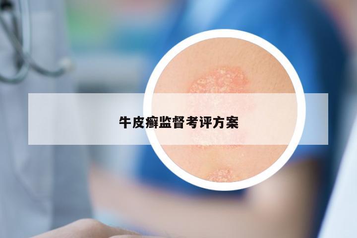 牛皮癣监督考评方案