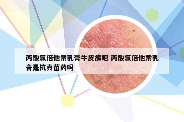 丙酸氯倍他索乳膏牛皮癣吧 丙酸氯倍他索乳膏是抗真菌药吗