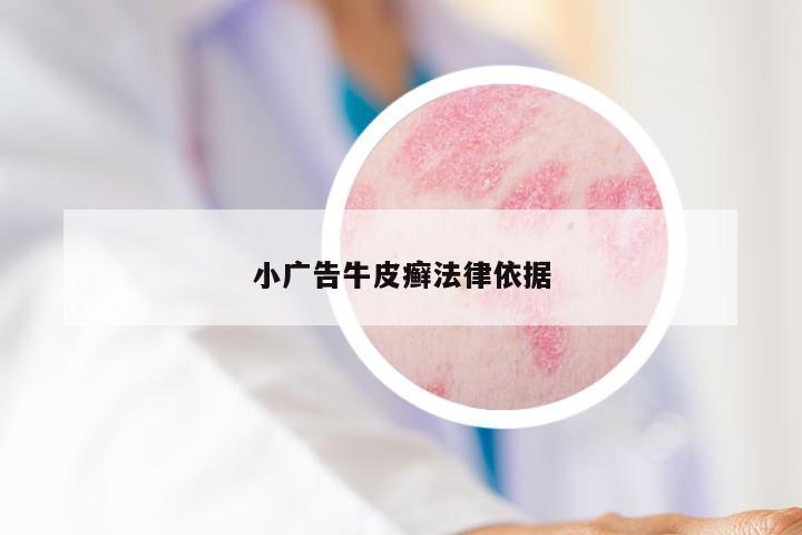 小广告牛皮癣法律依据