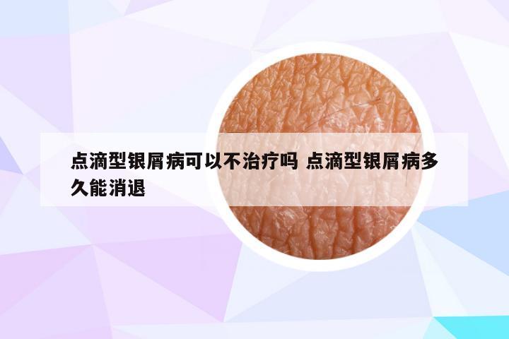 点滴型银屑病可以不治疗吗 点滴型银屑病多久能消退