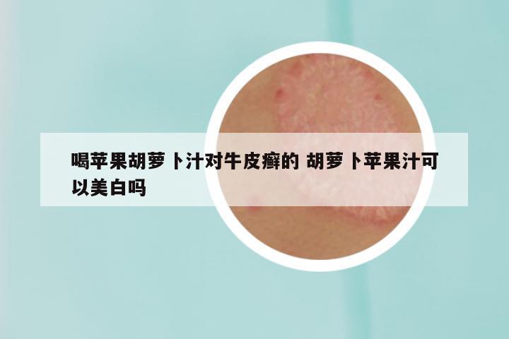 喝苹果胡萝卜汁对牛皮癣的 胡萝卜苹果汁可以美白吗