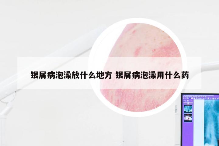 银屑病泡澡放什么地方 银屑病泡澡用什么药