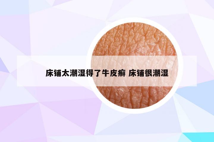 床铺太潮湿得了牛皮癣 床铺很潮湿