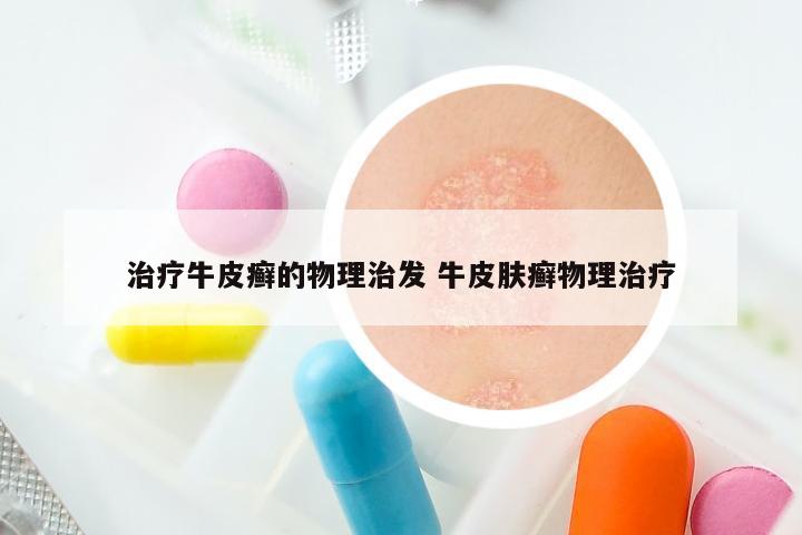 治疗牛皮癣的物理治发 牛皮肤癣物理治疗