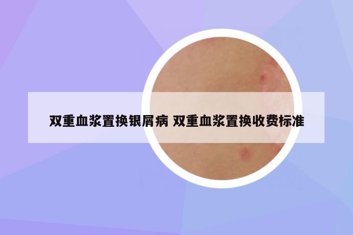 双重血浆置换银屑病 双重血浆置换收费标准