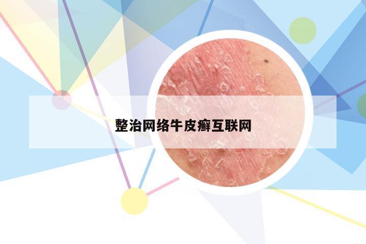 整治网络牛皮癣互联网