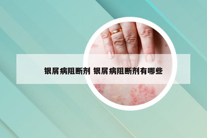 银屑病阻断剂 银屑病阻断剂有哪些