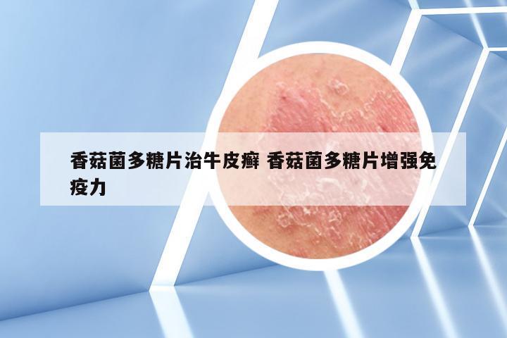 香菇菌多糖片治牛皮癣 香菇菌多糖片增强免疫力