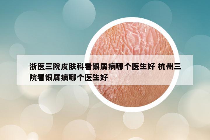 浙医三院皮肤科看银屑病哪个医生好 杭州三院看银屑病哪个医生好