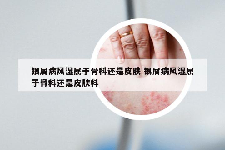 银屑病风湿属于骨科还是皮肤 银屑病风湿属于骨科还是皮肤科