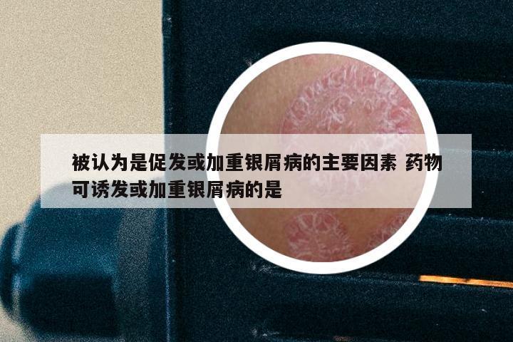 被认为是促发或加重银屑病的主要因素 药物可诱发或加重银屑病的是