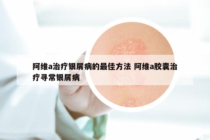 阿维a治疗银屑病的最佳方法 阿维a胶囊治疗寻常银屑病