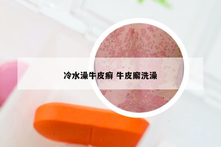 冷水澡牛皮癣 牛皮廨洗澡