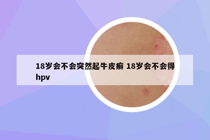18岁会不会突然起牛皮癣 18岁会不会得hpv