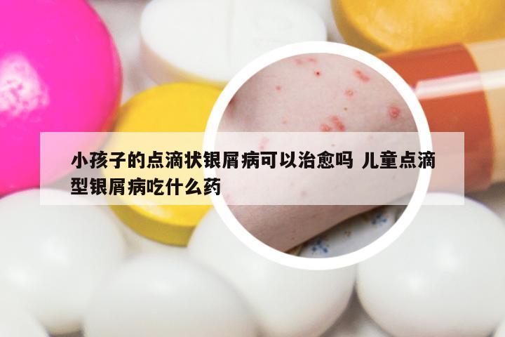 小孩子的点滴状银屑病可以治愈吗 儿童点滴型银屑病吃什么药