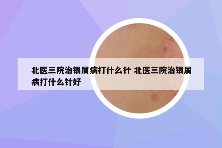 北医三院治银屑病打什么针 北医三院治银屑病打什么针好