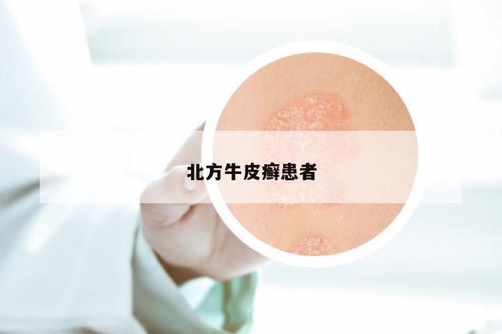 北方牛皮癣患者
