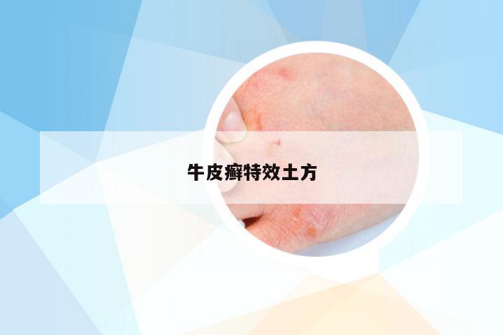 牛皮癣特效土方