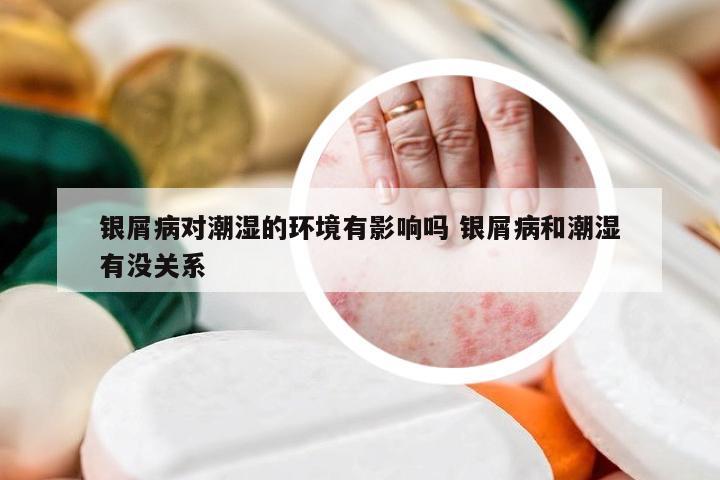 银屑病对潮湿的环境有影响吗 银屑病和潮湿有没关系