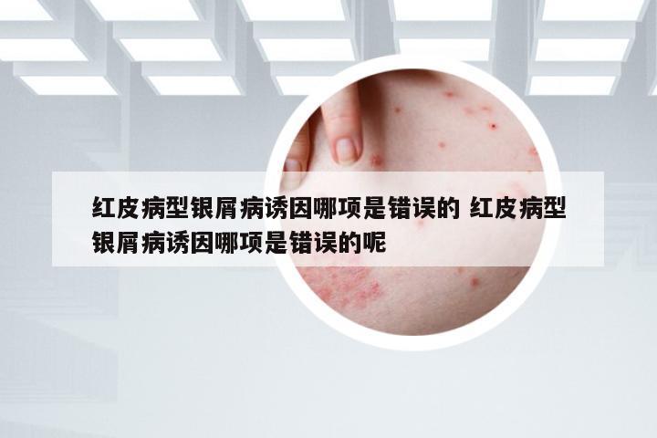 红皮病型银屑病诱因哪项是错误的 红皮病型银屑病诱因哪项是错误的呢