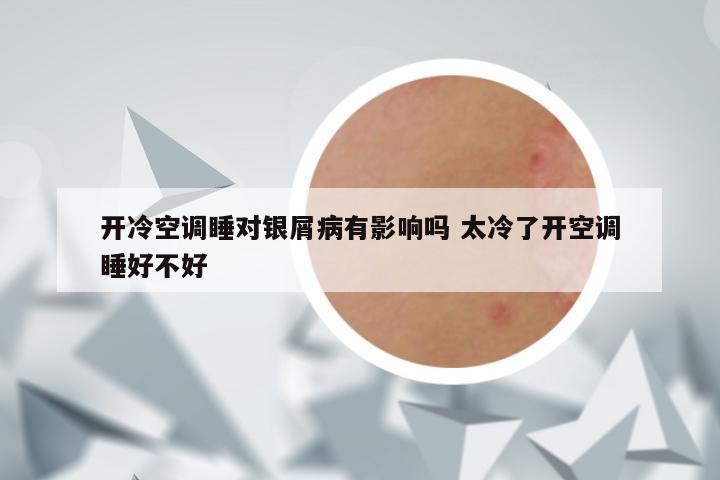 开冷空调睡对银屑病有影响吗 太冷了开空调睡好不好