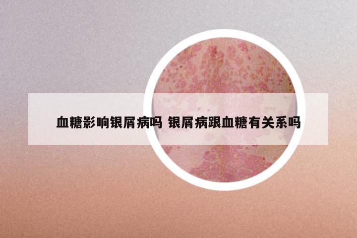 血糖影响银屑病吗 银屑病跟血糖有关系吗