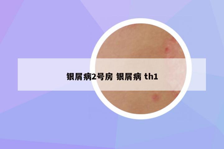 银屑病2号房 银屑病 th1