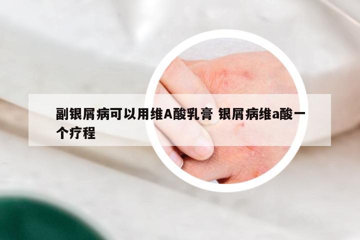 副银屑病可以用维A酸乳膏 银屑病维a酸一个疗程