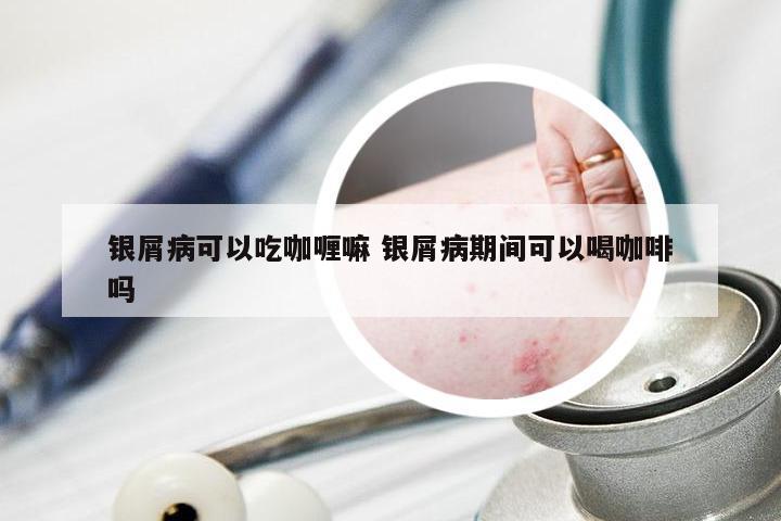 银屑病可以吃咖喱嘛 银屑病期间可以喝咖啡吗