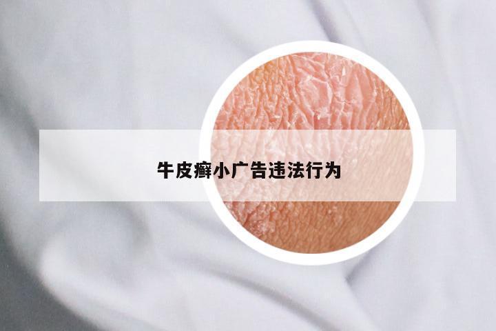 牛皮癣小广告违法行为