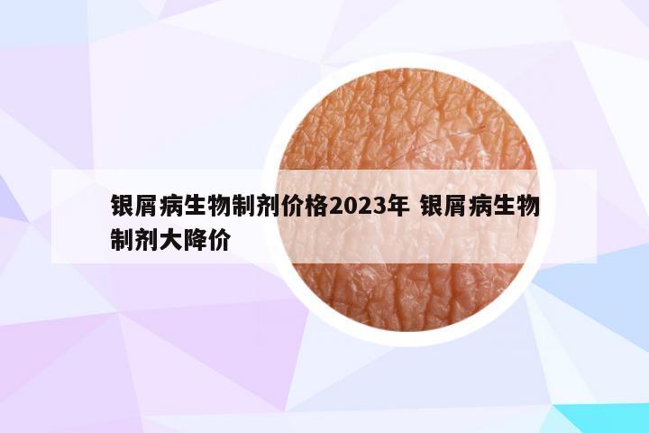 银屑病生物制剂价格2023年 银屑病生物制剂大降价