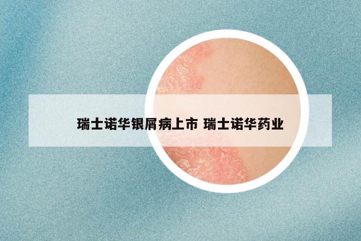 瑞士诺华银屑病上市 瑞士诺华药业