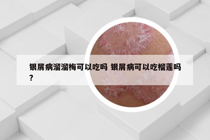 银屑病溜溜梅可以吃吗 银屑病可以吃榴莲吗?