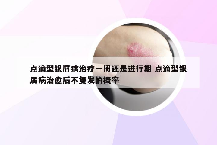 点滴型银屑病治疗一周还是进行期 点滴型银屑病治愈后不复发的概率
