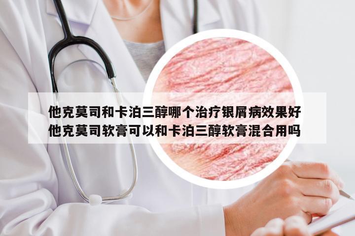 他克莫司和卡泊三醇哪个治疗银屑病效果好 他克莫司软膏可以和卡泊三醇软膏混合用吗
