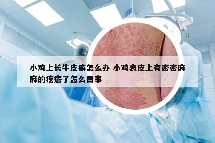 小鸡上长牛皮癣怎么办 小鸡表皮上有密密麻麻的疙瘩了怎么回事