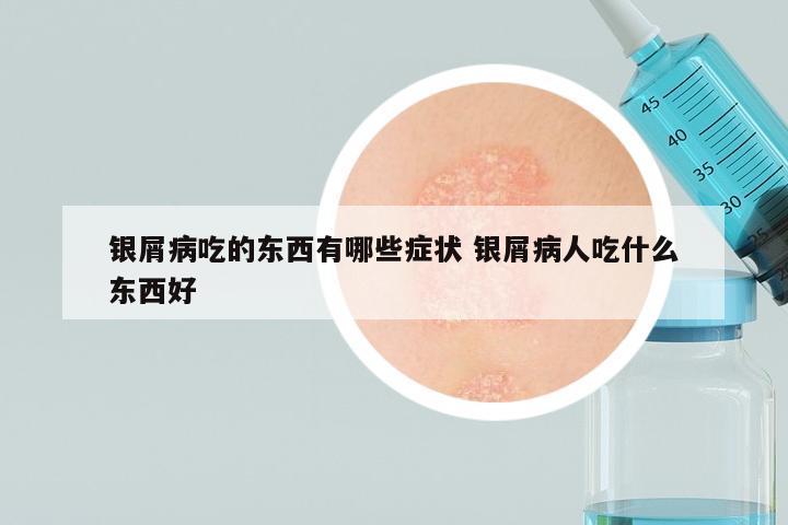 银屑病吃的东西有哪些症状 银屑病人吃什么东西好